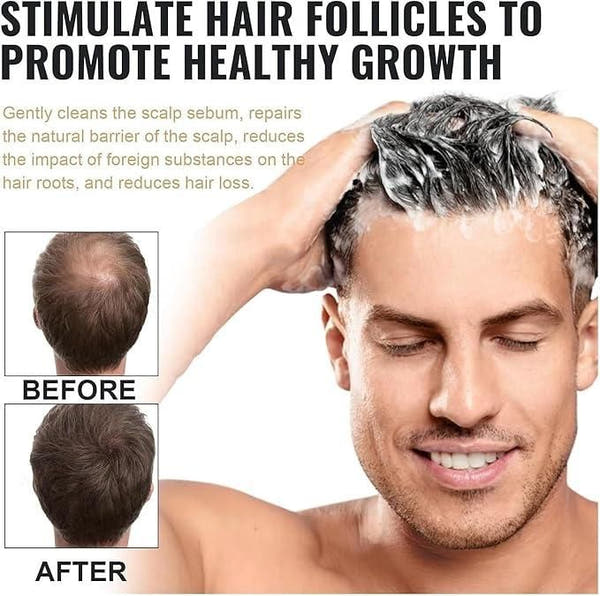 Root Activating Shampoo 100 ml Pack of 1